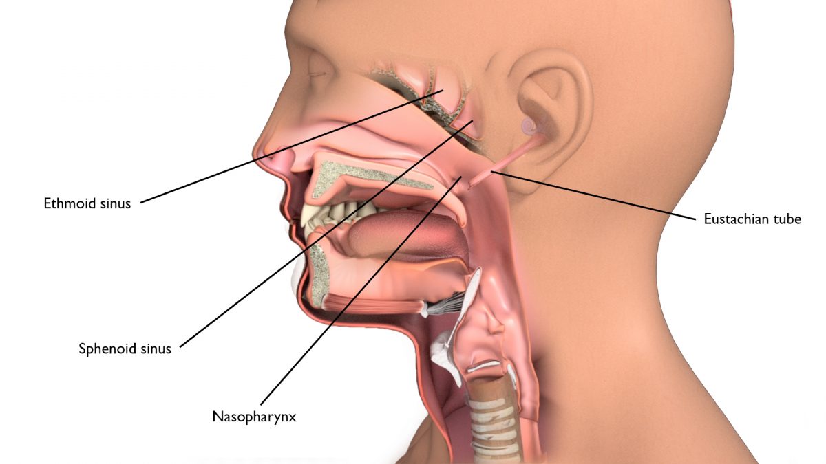 Larynx cancer