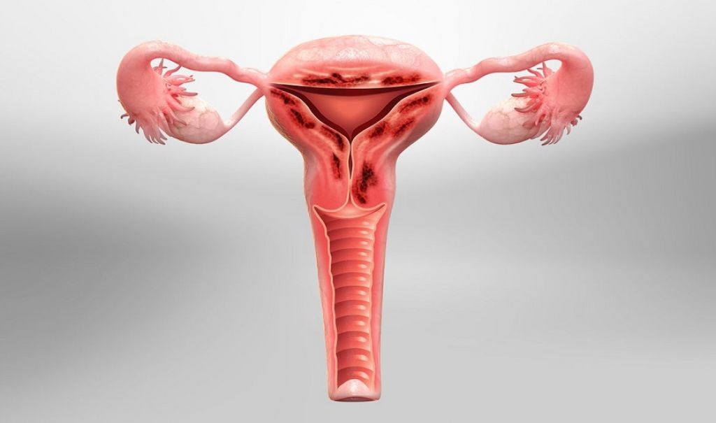 Vulvar cancer: how is it manifested and treated?